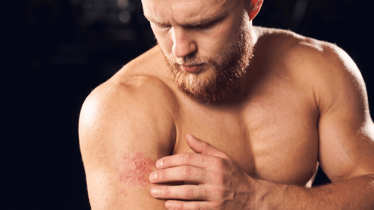 BJJ skin infections check: athlete inspecting an early mark on his forearm after training